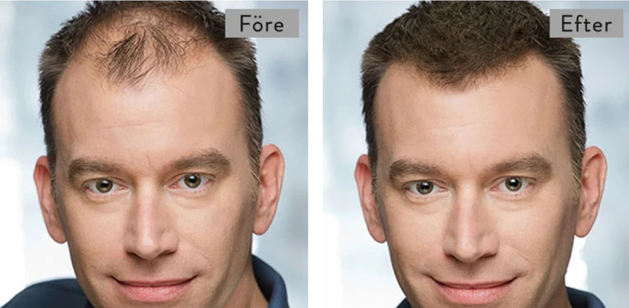 Toppik Hair Thickening - Per capelli più folti e sani in un istante!