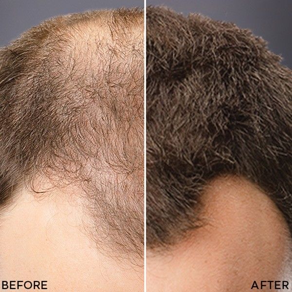 Toppik Hair Thickening - För tjockare, friskare hår på ett ögonblick!