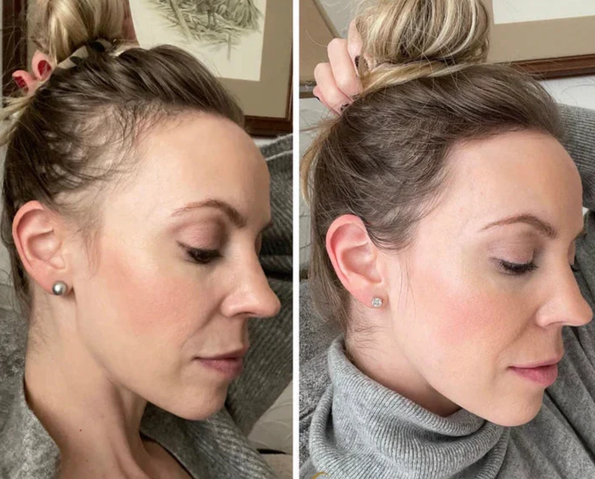 Få tilbake fyldigere, sterkere hår – naturlig og effektivt!