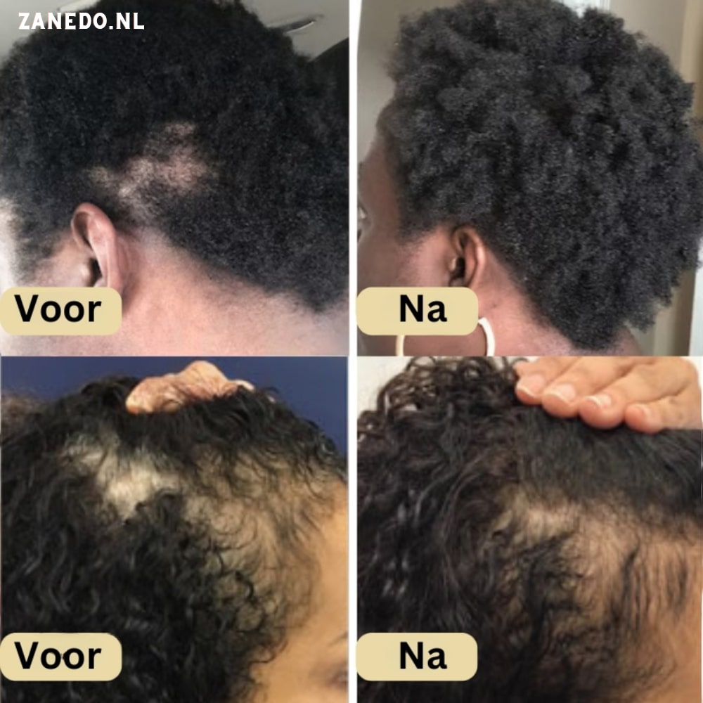 Natuurlijke Haargroei Olie - Veganic Zanedo